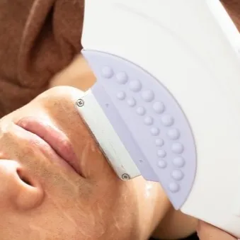 ✨ヒゲ脱毛、始めるなら今！